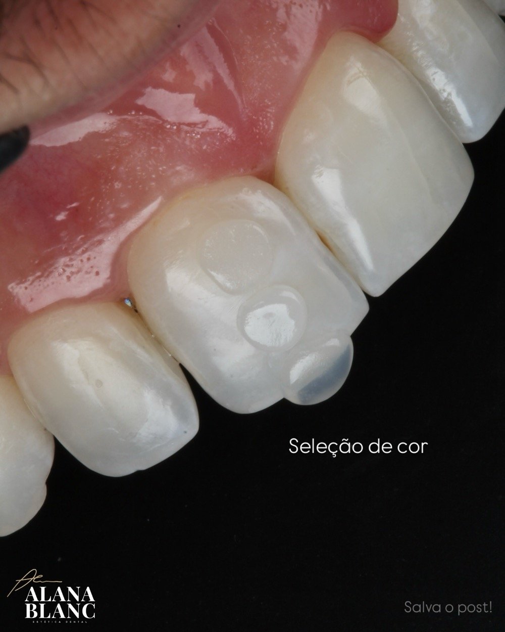 Selección de color de resina — Día 1, Excelencia en Resinas
